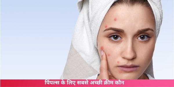 पिंपल्स के लिए सबसे अच्छी क्रीम कौन सी है Pimple Ke Liye Best Cream